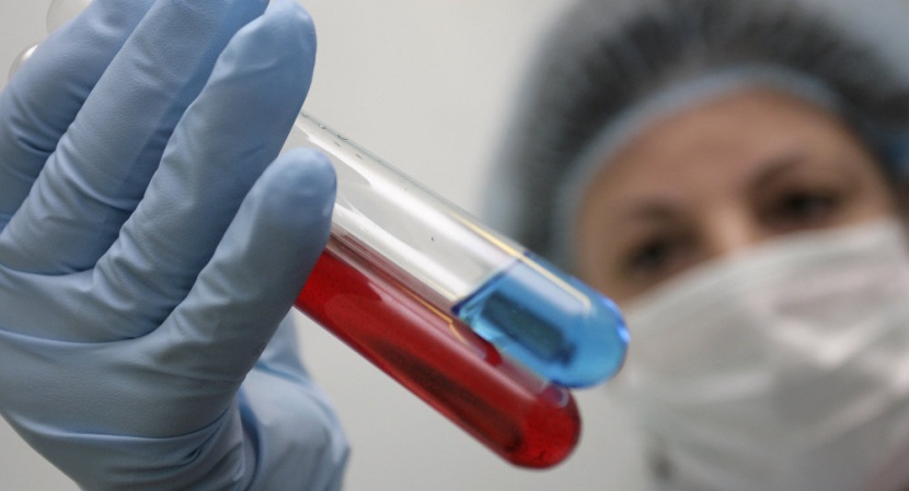 الامم المتحدة: استمرار علاج 16 مليون من الايدز مع تراجع الاصابات 35% منذ بداية الألفية