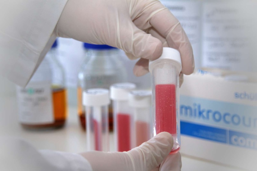 رصد سلالة من إنفلونزا الخنازير تهدد بوباء عالمي