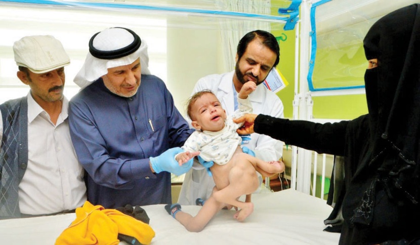 إنفاذا لتوجيهات خادم الحرمين.. وصول التوأم السيامي اليمني من تعز وبدء الفحوص