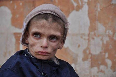 الفاو: أكثر من نصف سكان سوريا يعانون من انعدام الأمن الغذائي