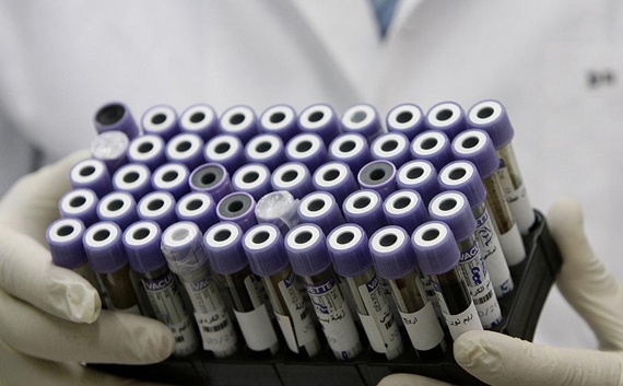 علماء : الـ"دي إن إيه" يحدد عمر المشتبه به في مسرح الجريمة