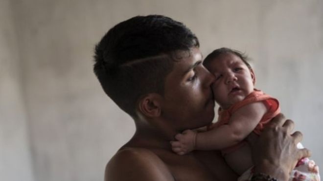 ماذا تعرف عن تفشي فيروس "زيكا"