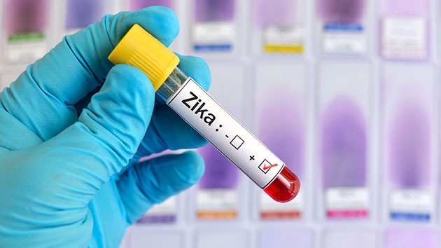 أكثر من 2100 امرأة حامل مصابة بفيروس زيكا في كولومبيا