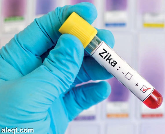 البرازيل تجيز اقتحام ممتلكات خاصة لمحاربة فيروس زيكا