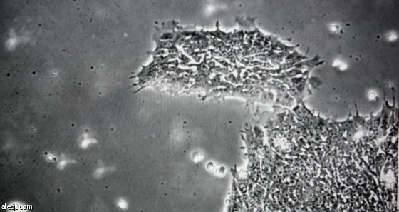 بريطانيا توافق على "التعديل الجيني" للأجنة البشرية لأغراض البحث العلمي