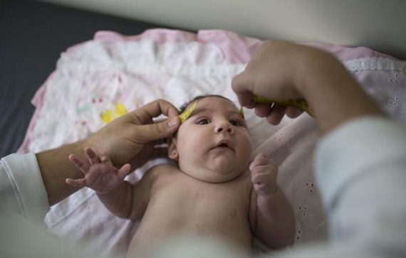 البرازيل : عدد حالات الإصابة بفيروس زيكا تخطى الـ 4 آلاف