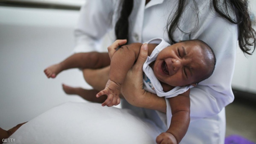 لغز طبي أدى لاكتشاف فيروس زيكا في البرازيل