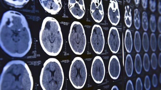 بصمات دماغك يمكن أن تفضحك عندما تكذب