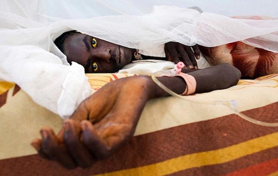 أنجولا تعلن وفاة 37 شخصا بعد تفشي الحمى الصفراء