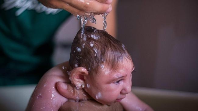 خبراء: فيروس زيكا قد يختبئ في أعضاء بجسم الإنسان محمية من جهاز المناعة