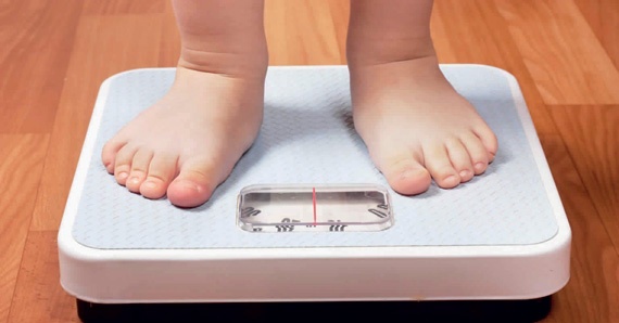 مختص: وفاة 20 ألف  شخص سنويا في السعودية بسبب أمراض السمنة