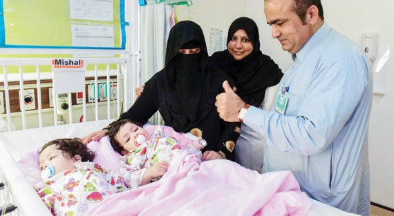 التوأم الباكستاني «مشاعل» و«فاطمة» تغادران العناية الفائقة في حالة مستقرة