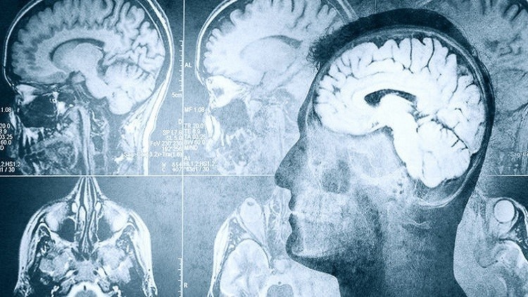 العلماء يؤكدون وجود صلة بين اضطرابات النوم والذاكرة