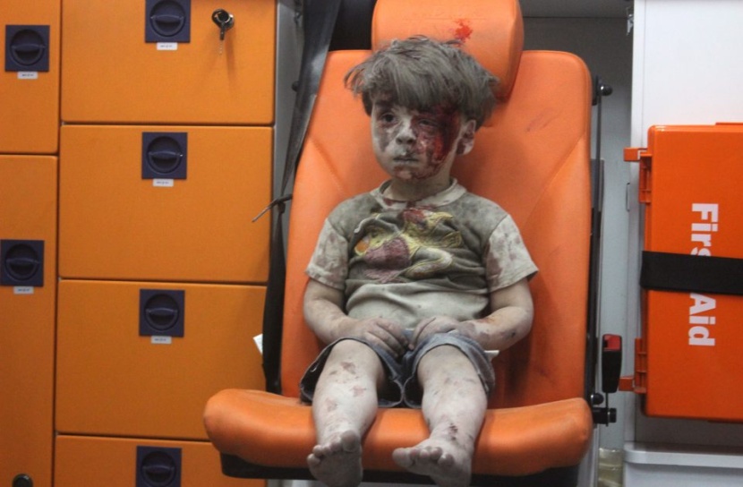 وفاة شقيق الطفل عمران بمستشفى في حلب