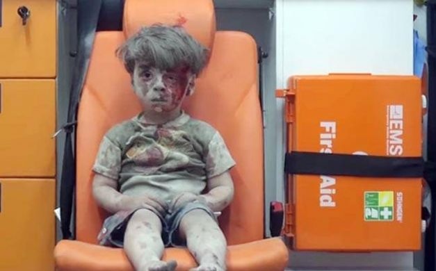 وفاة شقيق طفل حلب "عمران" متأثرا بجروحه