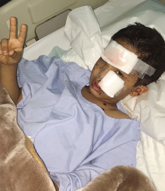 والد الطفل شهيد نجران: الوطن غال .. ومستعدون لتقديم مزيد