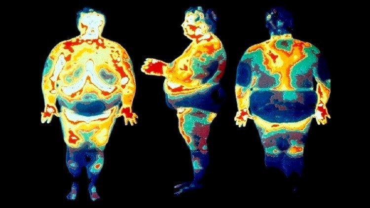 دراسة: الميكروبات قد تكون السبب في السمنة