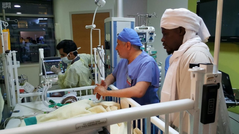 نجاح عملية فصل التوأم السوداني "رماح ووضاح"