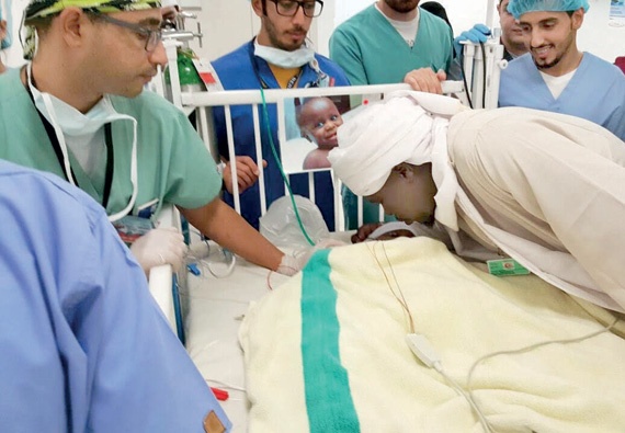 بعد أن استغرقت 11 ساعة.. نجاح عملية فصل التوأم السوداني «رماح ووضاح»