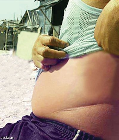 السوق السوداء الجديدة لبيع الكلى.. إرغام الفقراء  على التبرع للأغنياء