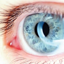 الإنتراليزك .. دون مشرط .. دون ألم .. وبأمان تام