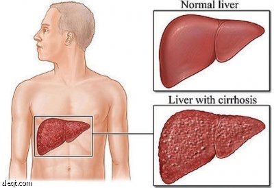 د. ماتاني: لابد من استشارة المتخصصين لصحة أفضل في رمضان