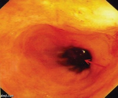 د. ماتاني: لابد من استشارة المتخصصين لصحة أفضل في رمضان