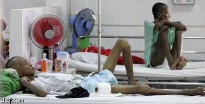 نجاح لقاح تجريبي في الحد من مخاطر الإصابة بالإيدز