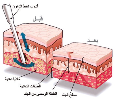 بإمكـان المرأة الحصول على قوام جميل ومتناسق
