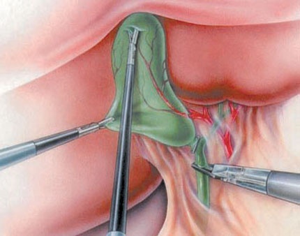 يتم تطبيق المعايير والمواصفات العالمية بغرف العمليات وكذلك آخرالمستجدات الطبية ضمانا  لنجاح العمليات
