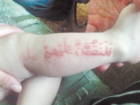 آيات من الذكر الحكيم تظهر وتختفي على جلد رضيع روسي في داغستان