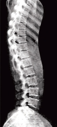 جهاز CARDIAC CT – SCAN يكتشف الجلطات الرئوية والقلبية مبكرا