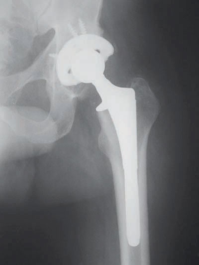 كفاءات عالمية لإجراء عمليات المفاصل الصناعية بمهارة ودقة متناهية