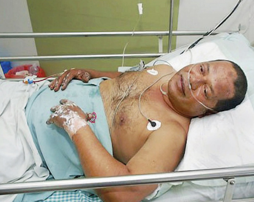 إنقاذ 8 ركاب من الحطام المشتعل لطائرة «الهند إكسبرس» ومقتل 159