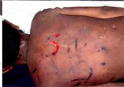 العنف الأسري .. أرقام مفزعة تكشف عن الظاهرة في السعودية