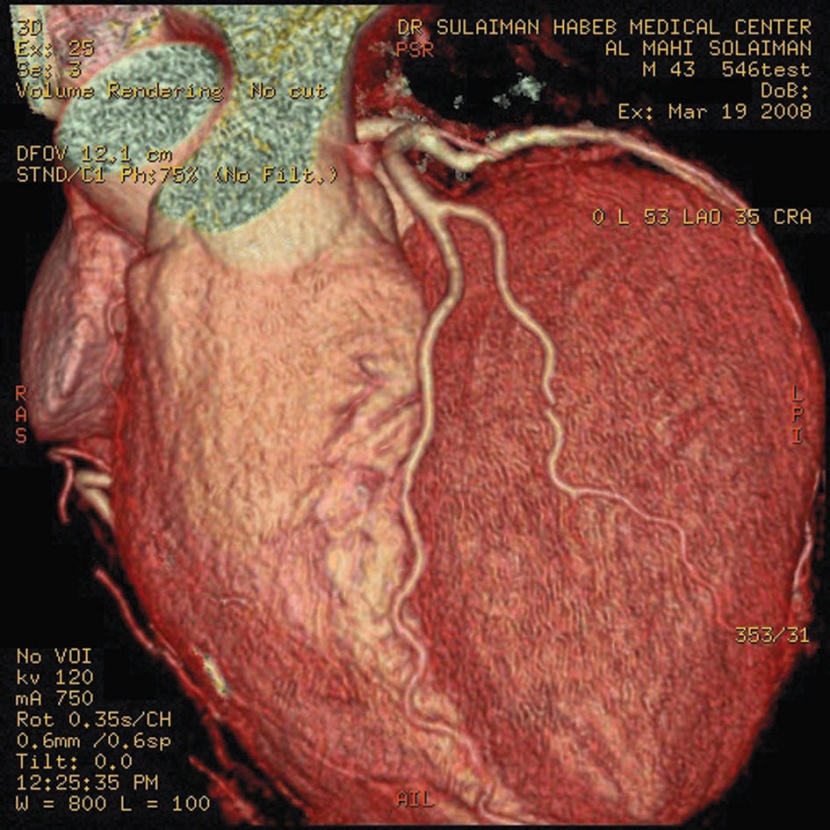 أطباء: الاكتشاف المبكر للجلطات القلبية والرئوية يجنب المضاعفات بنسبة 90 %