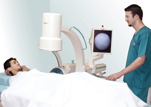 حصيات الكلى من أكثر الأمراض شيوعاً.. ونسبة الإصابة بين الرجال أعلى من النساء