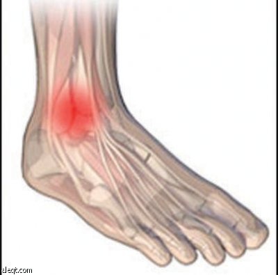 تقنية الجرح الصغير بالمنظار تسهم في الشفاء من الإصابات الرياضية