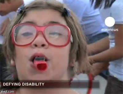 150 مليون طفل من ذوي الاحتياجات الخاصة في العالم بحاجه لتأهيل (فيديو)