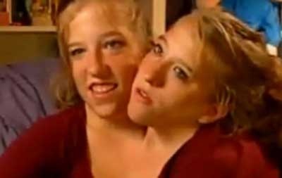 برنامج تلفزيوني أمريكي جديد لمتابعة الحياة اليومية لتوأمتين ملتصقتين - فيديو