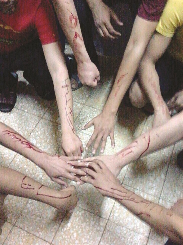 الكويت .. سجناء يقطعون شرايينهم بسبب الإهمال والروتين