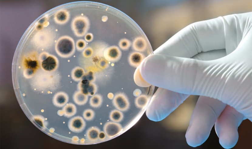 دراسة.. تحذر من خطر ارتفاع عدد الوفيات الناتجة عن الجراثيم متعددة المقاومة