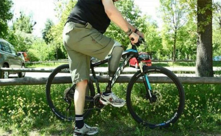 علماء يبتكرون رجلا صناعية تتيح لصاحبها الشعور بها