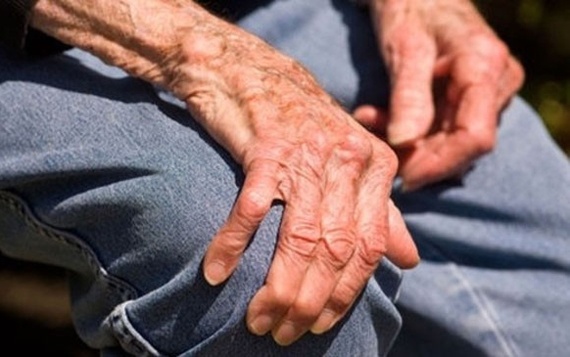 الولايات المتحدة توافق على جهاز جديد لمرضى باركنسون