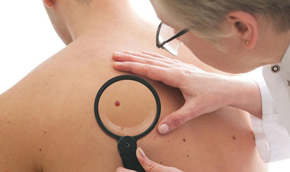 الأطباء يحددون أعراض الأمراض السرطانية التي تستوجب مراجعتهم