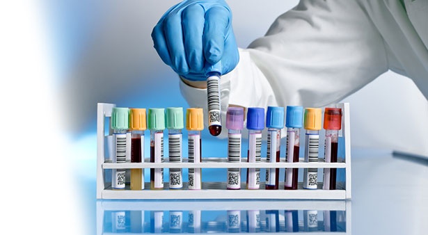 وفاة مسن بـ"الطاعون" في ولاية يوتا بالولايات المتحدة