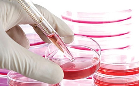 نتائج واعدة لعلاج إصابات النخاع الشوكي بالخلايا الجذعية