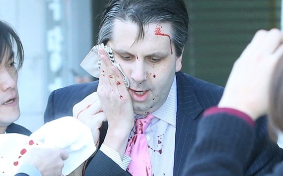 السجن 12 عاما للكوري الذي طعن السفير الأمريكي في وجهه