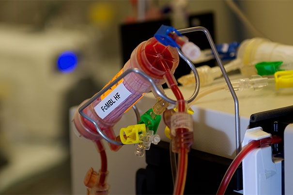 جهاز جديد ينقذ الملايين من ضحايا التسمم الدموي