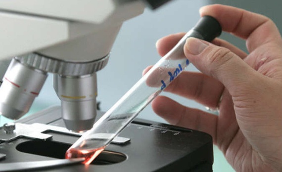 الصحة العالمية : انخفاض حالات الإصابة بالملاريا حول العالم